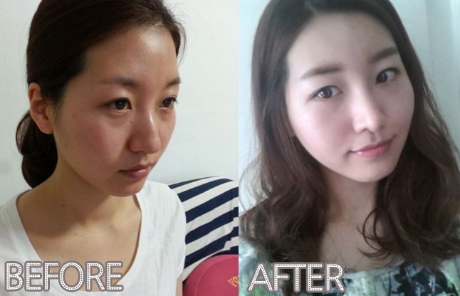 Joy’s Plastic Surgery Real Review