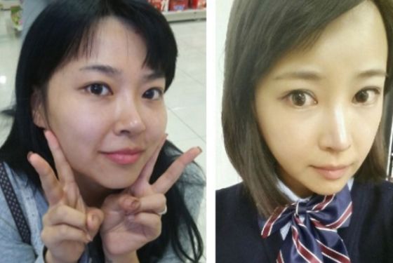 Jeeny’s Plastic Surgery Real Review