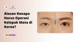 Alasan Kenapa Harus Operasi Kelopak Mata di Korea?