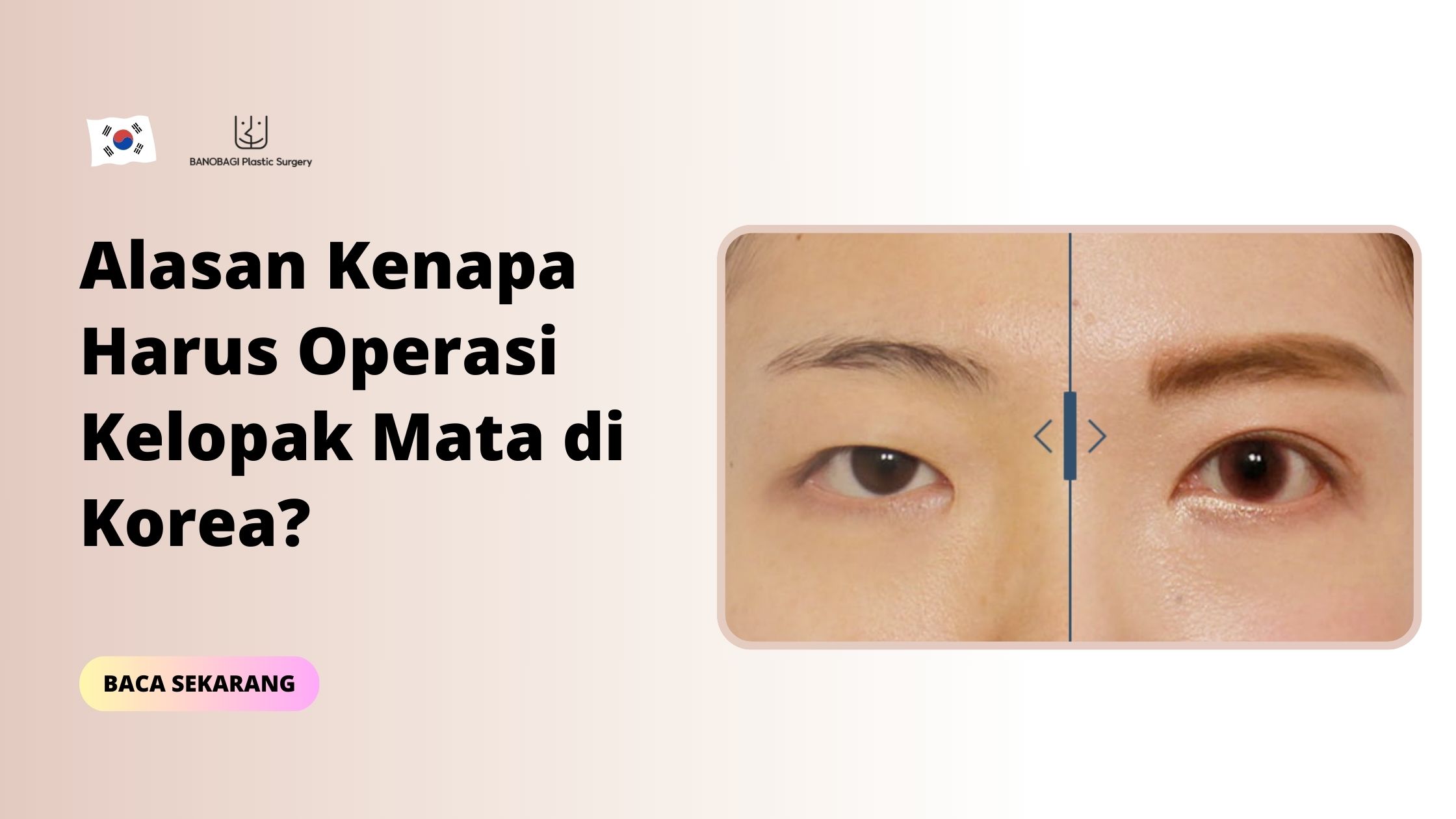 Operasi Kelopak Mata di Korea