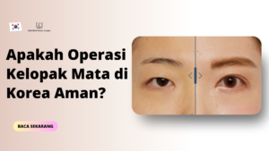 Apakah Operasi Kelopak Mata di Korea Aman?