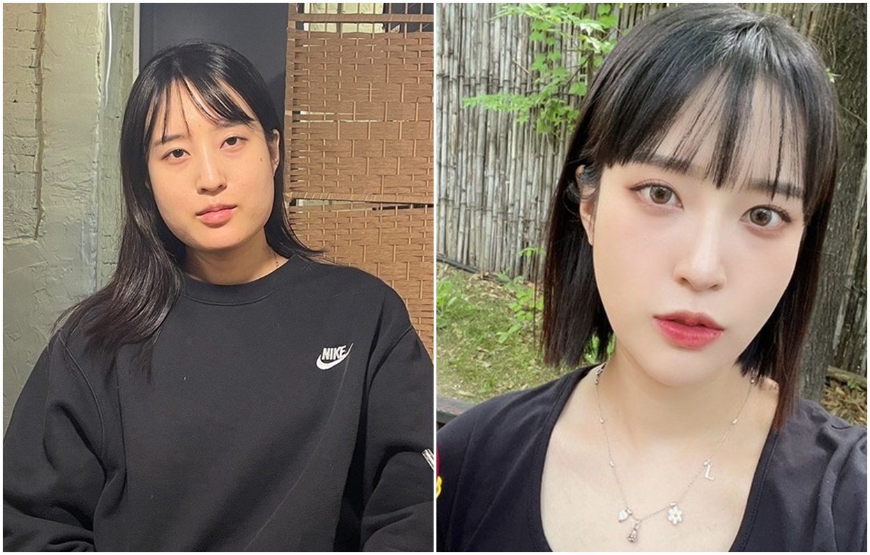 Kontur wajah 2 bagian: Reduksi Tulang Pipi & Rahang