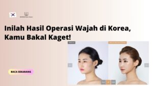 Inilah Hasil Operasi Wajah di Korea, Kamu Bakal Kaget!