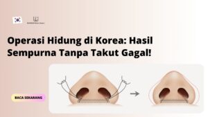 Operasi Hidung di Korea: Hasil Sempurna Tanpa Takut Gagal!