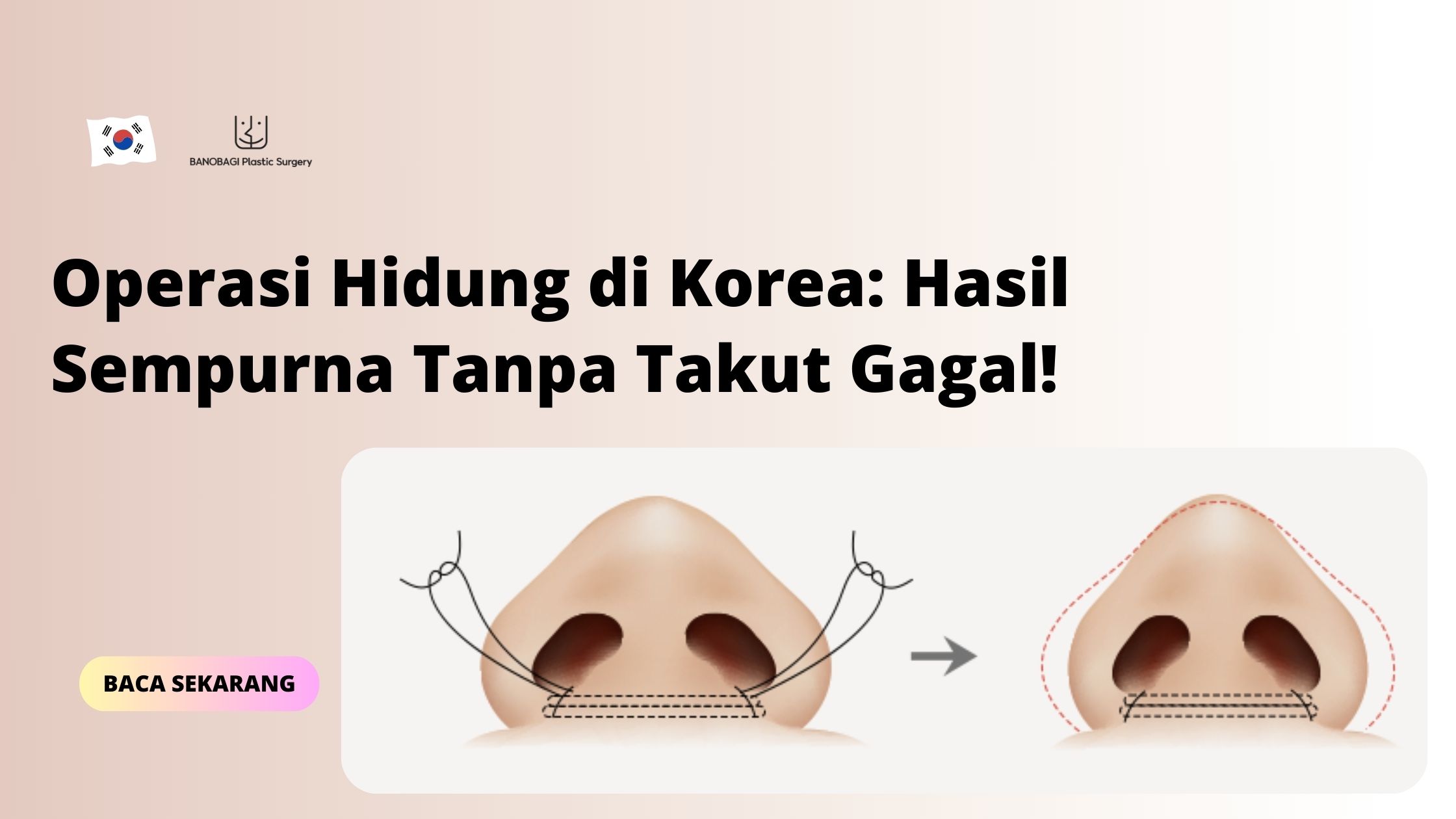 Operasi hidung di Korea