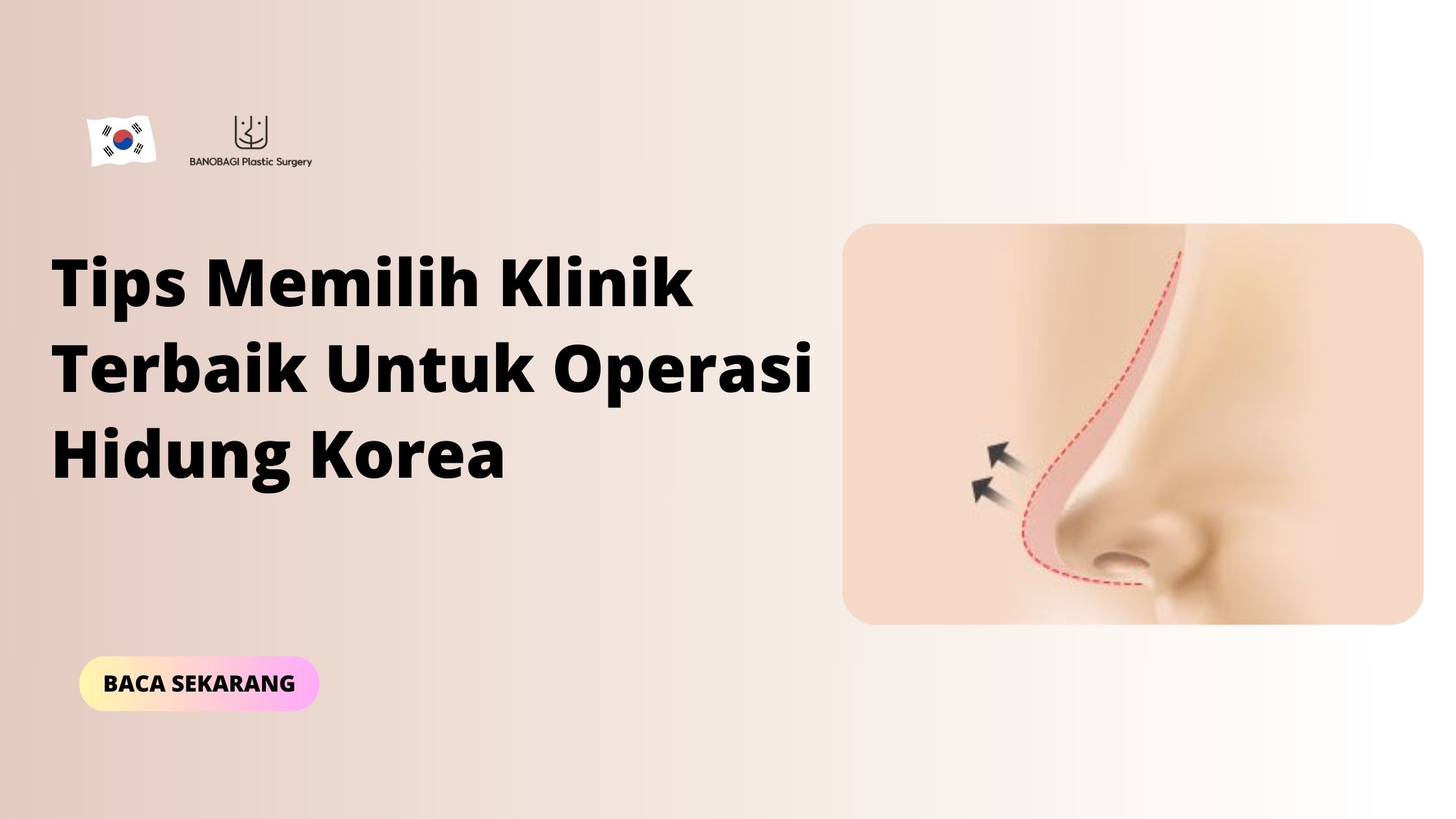 operasi hidung korea