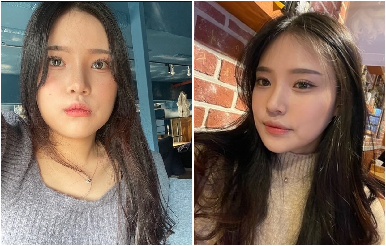 Kontur Wajah 3 Bagian, 4 Bulan Langsung Tirus!