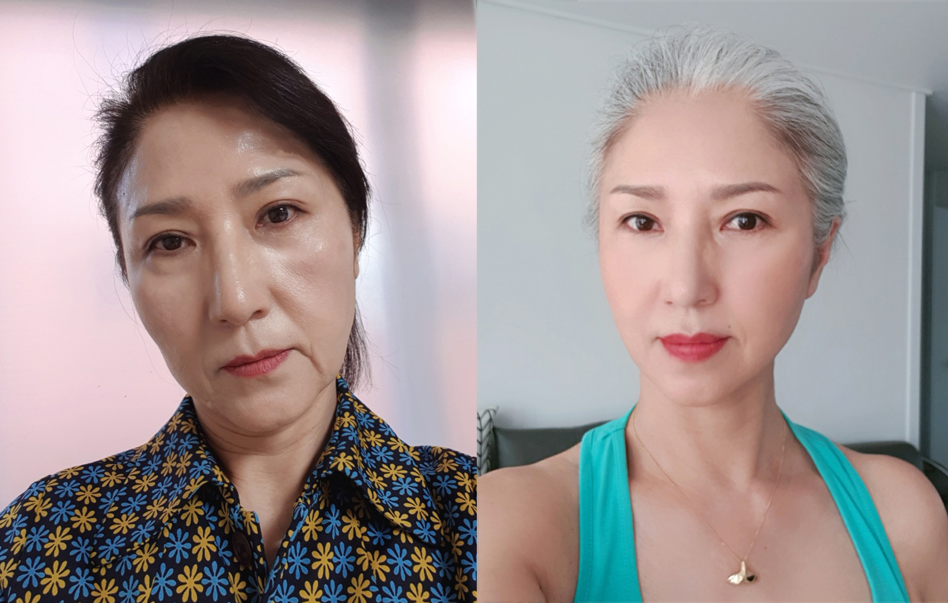 Jadi Model Senior Setelah Operasi Face Lifting