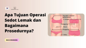 Apa Tujuan Operasi Sedot Lemak dan Bagaimana Prosedurnya?
