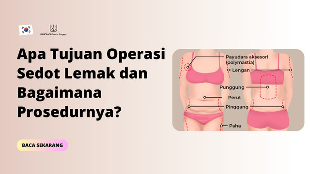 operasi sedot lemak
