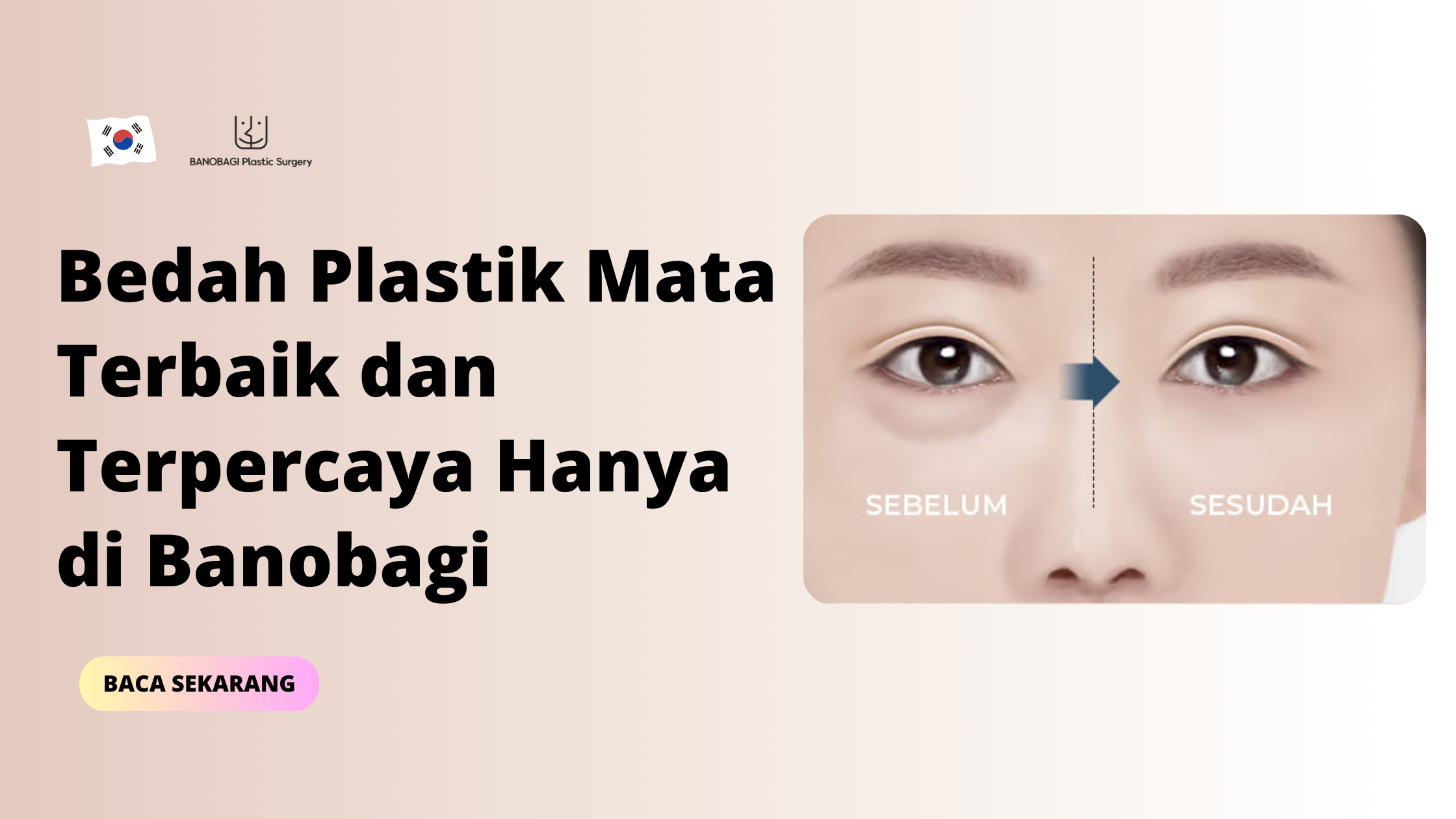 bedah plastik mata terbaik