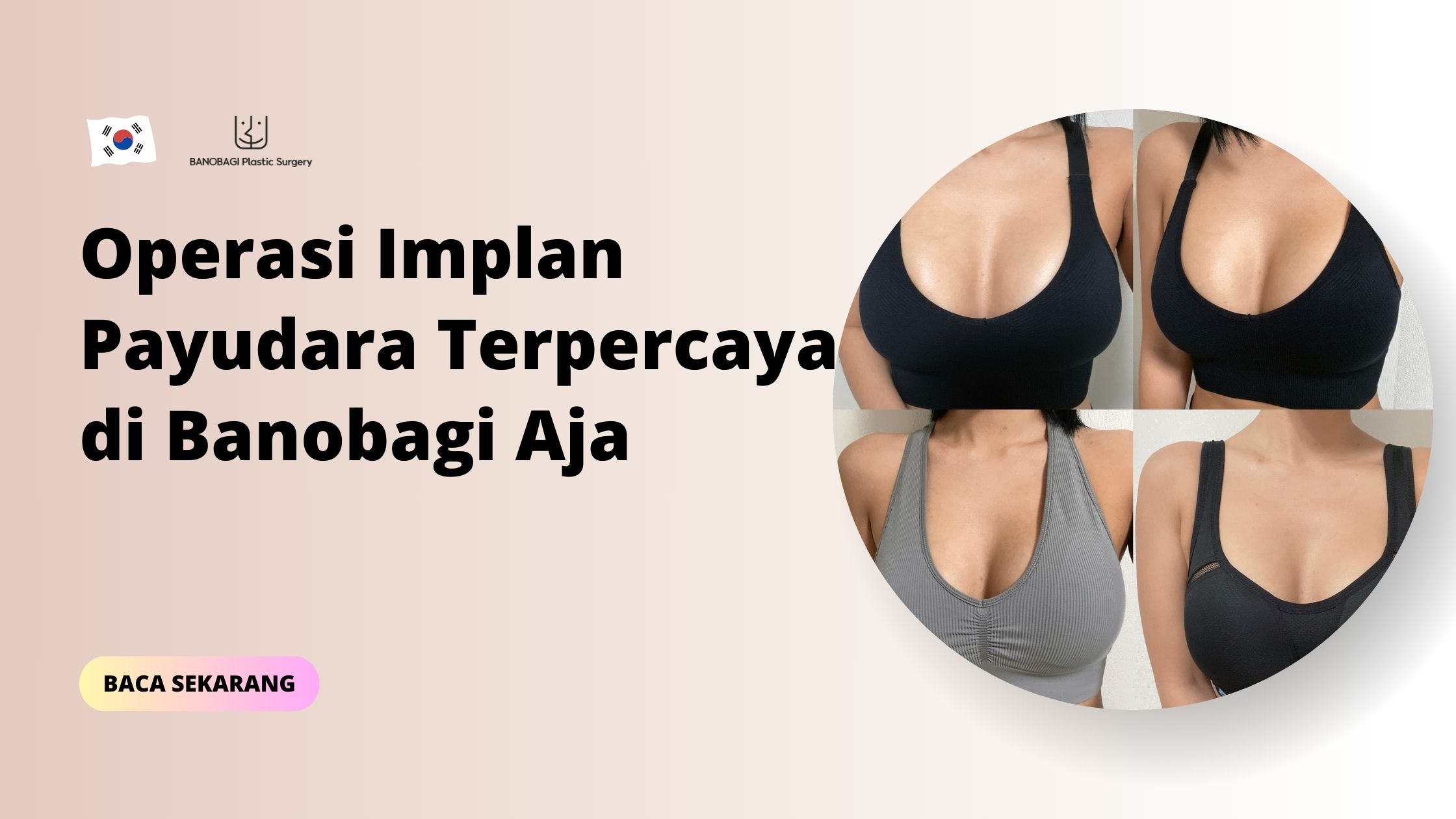 operasi implan payudara terpercaya