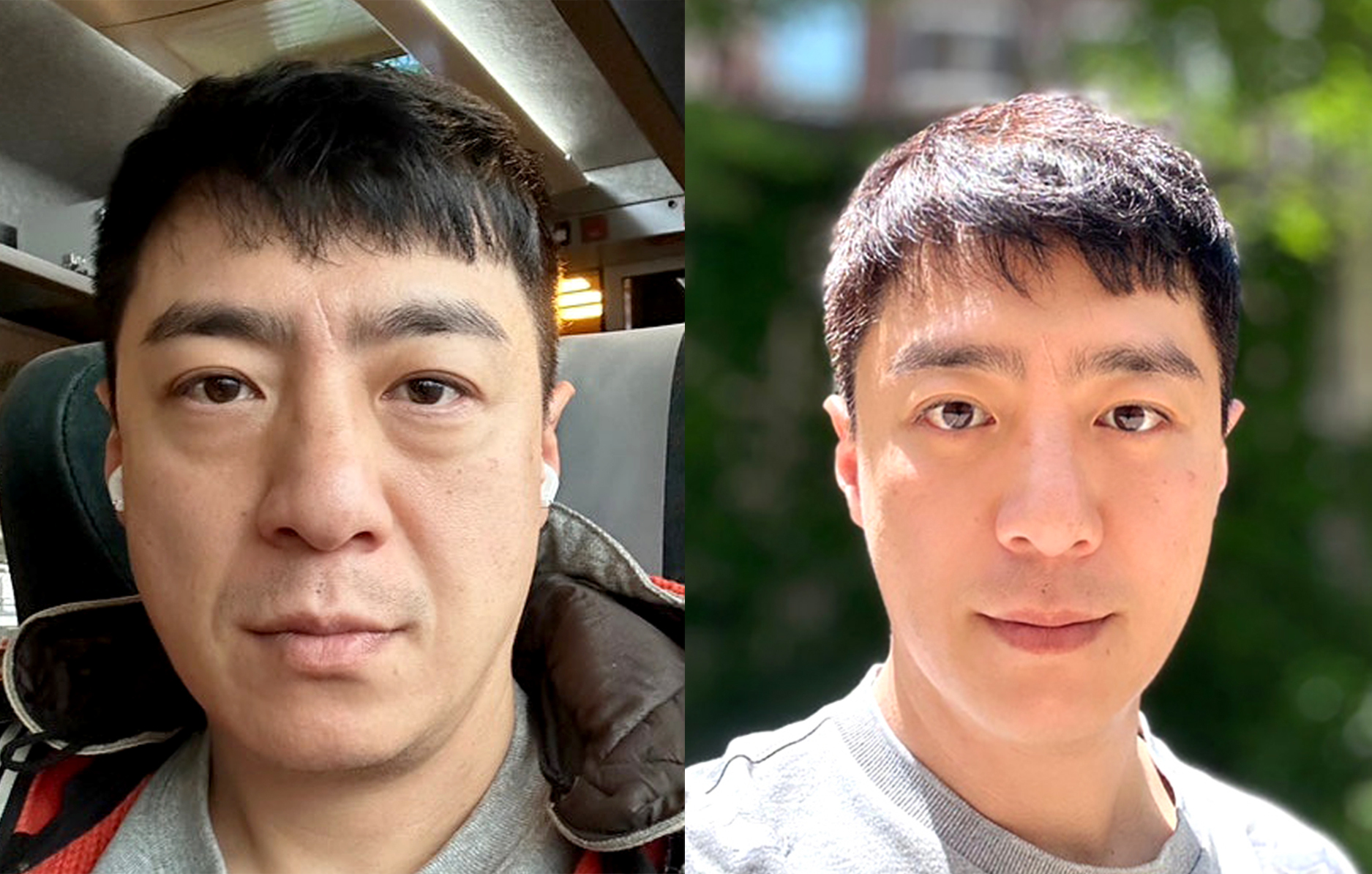 Rahasia Awet Muda: Face Lifting BANOBAGI