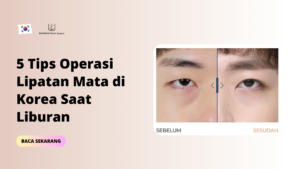 5 Tips Operasi Lipatan Mata di Korea Saat Liburan