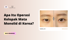 Apa Itu Operasi Kelopak Mata Monolid di Korea?