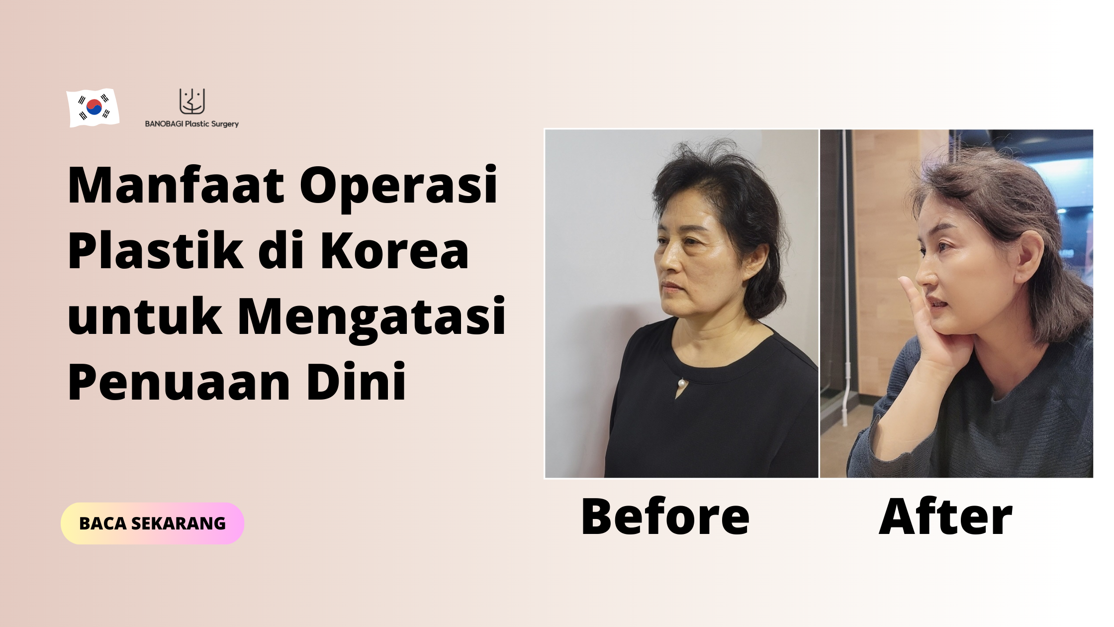 Manfaat Operasi Plastik