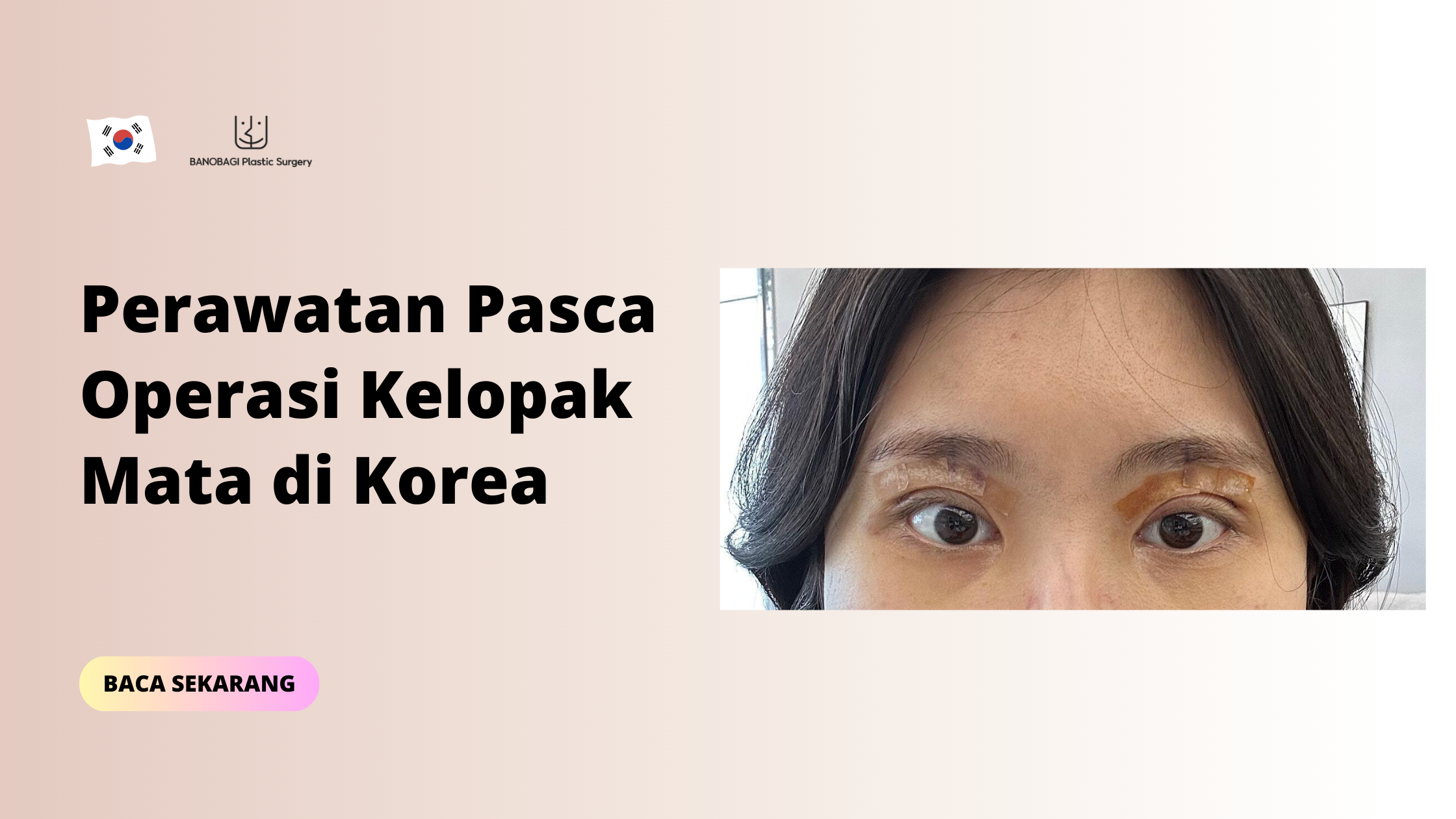 Perawatan Pasca Operasi Kelopak