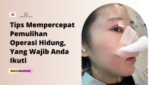 Tips Mempercepat Pemulihan Operasi Hidung, Yang Wajib Anda Ikuti