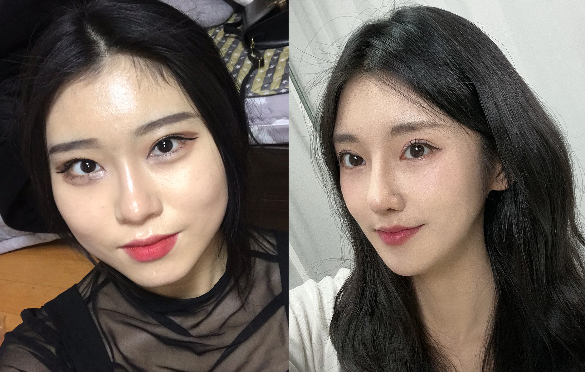 Transformasi Total: Operasi Two Jaw, Kontur Wajah, Mata, dan Hidung Sekaligus!