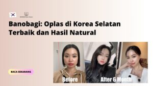 Banobagi: Oplas di Korea Selatan Terbaik dan Hasil Natural