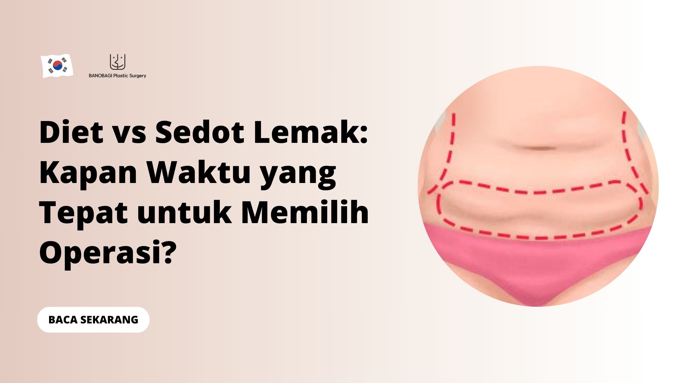 Diet vs Sedot Lemak