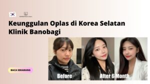 Keunggulan Oplas di Korea Selatan Klinik Banobagi