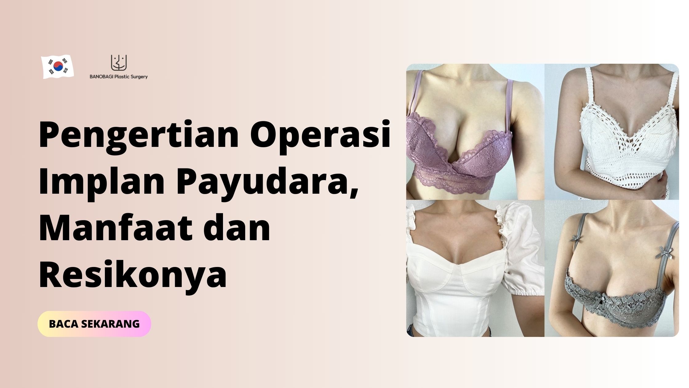 Pengertian Operasi Implan Payudara