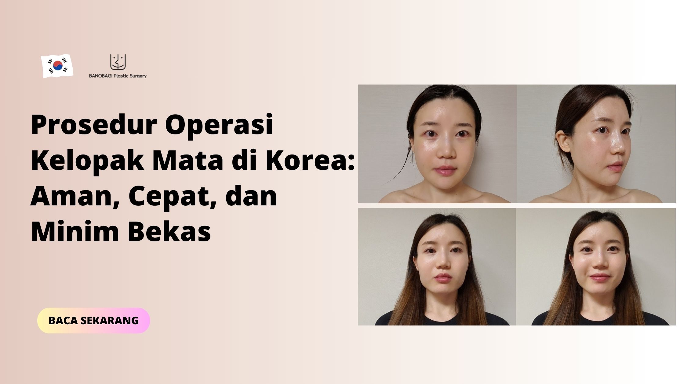 Prosedur Operasi Kelopak Mata