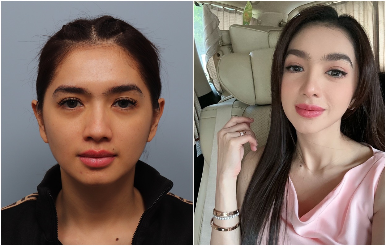 Rahasia Wajah Tirus dan Proporsional Artis Indonesia, Angel Karamoy!