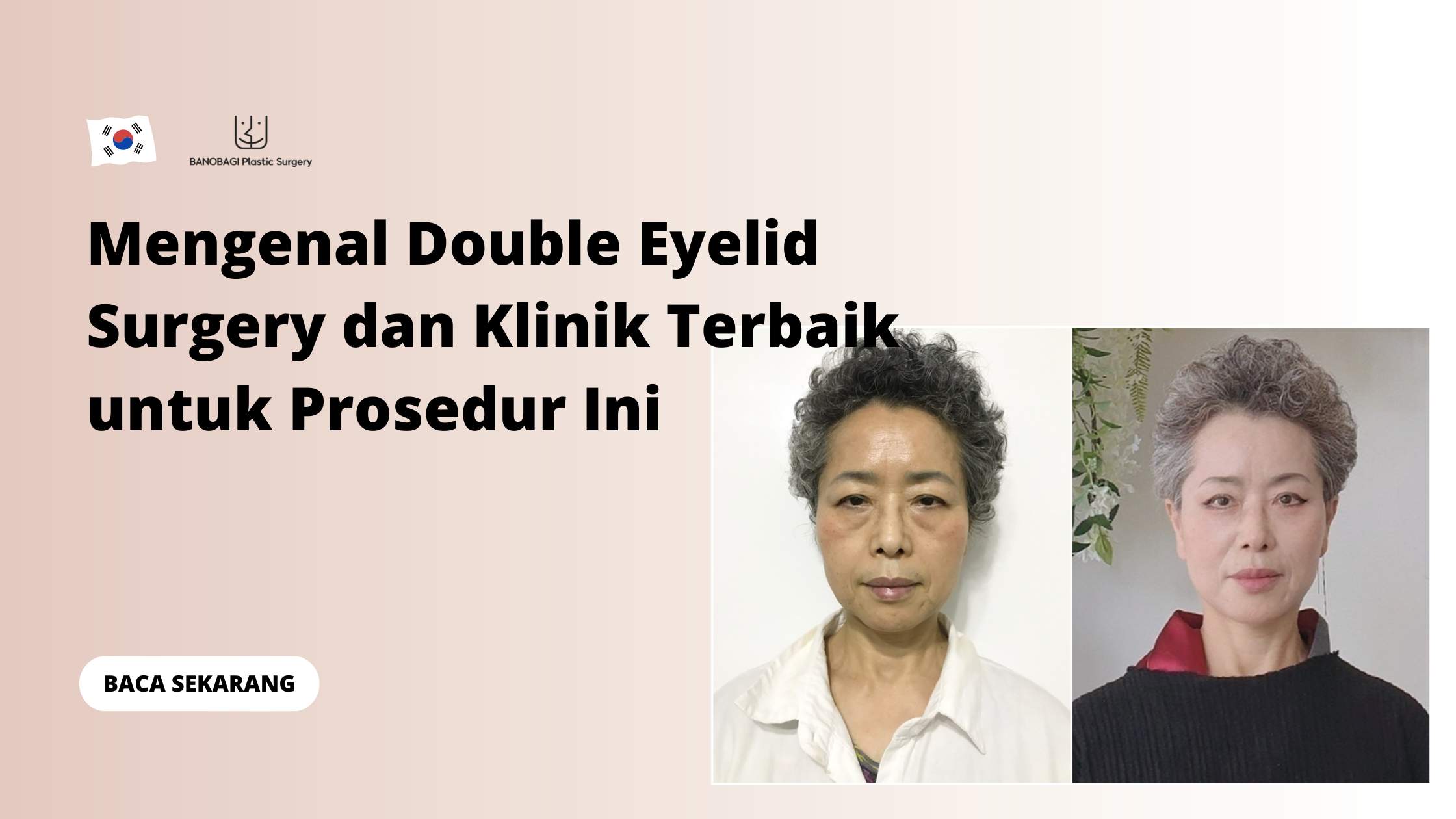 Mengenal Double Eyelid Surgery