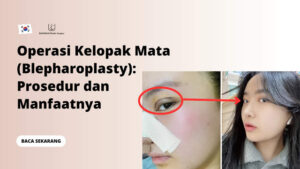 Operasi Kelopak Mata (Blepharoplasty): Prosedur dan Manfaatnya