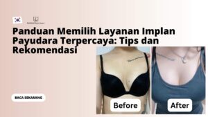 Panduan Memilih Layanan Implan Payudara Terpercaya: Tips dan Rekomendasi