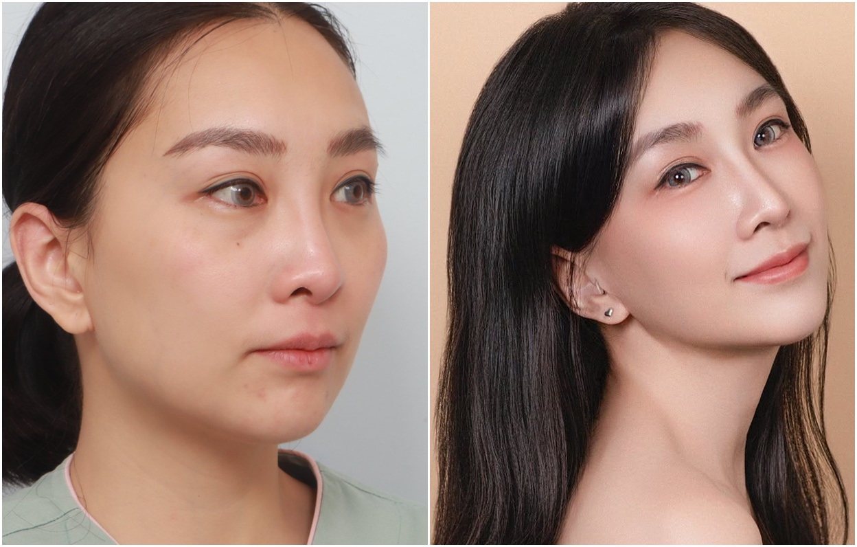 Jadi Sexy dan Hot Mom Setelah Operasi Wajah dan Tubuh Sekaligus!