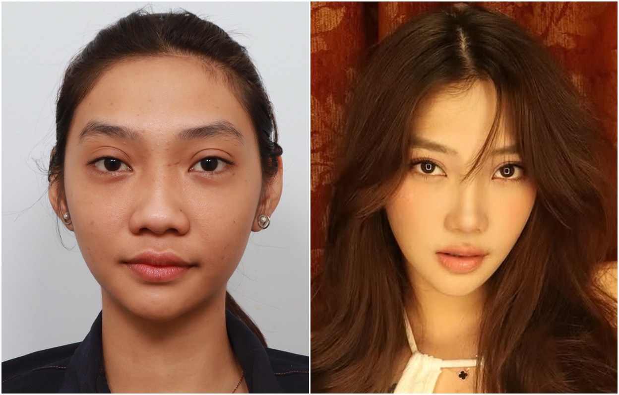 1 Wajah 3 Prosedur! Transformasi Cindy Bersama BANOBAGI