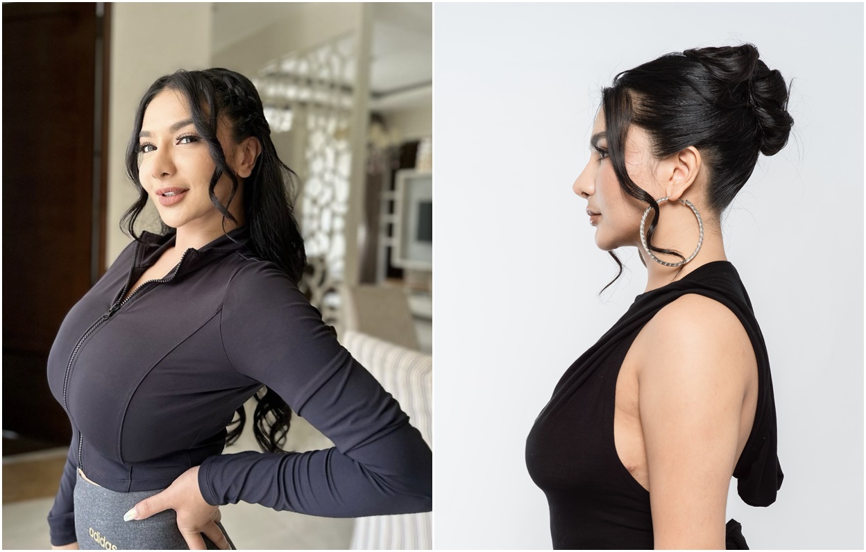 Kembali Seperti ABG Setelah Breast Reduction dan Breast Lift!