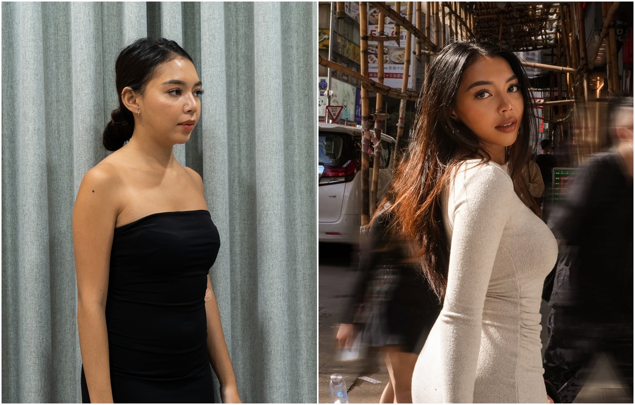 Travel Influencer Ke Korea Untuk Operasi 3 Prosedur!