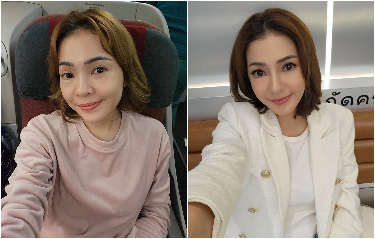 Maya Septha, Tampil Lebih Muda dan Cantik Setelah Operasi di BANOBAGI