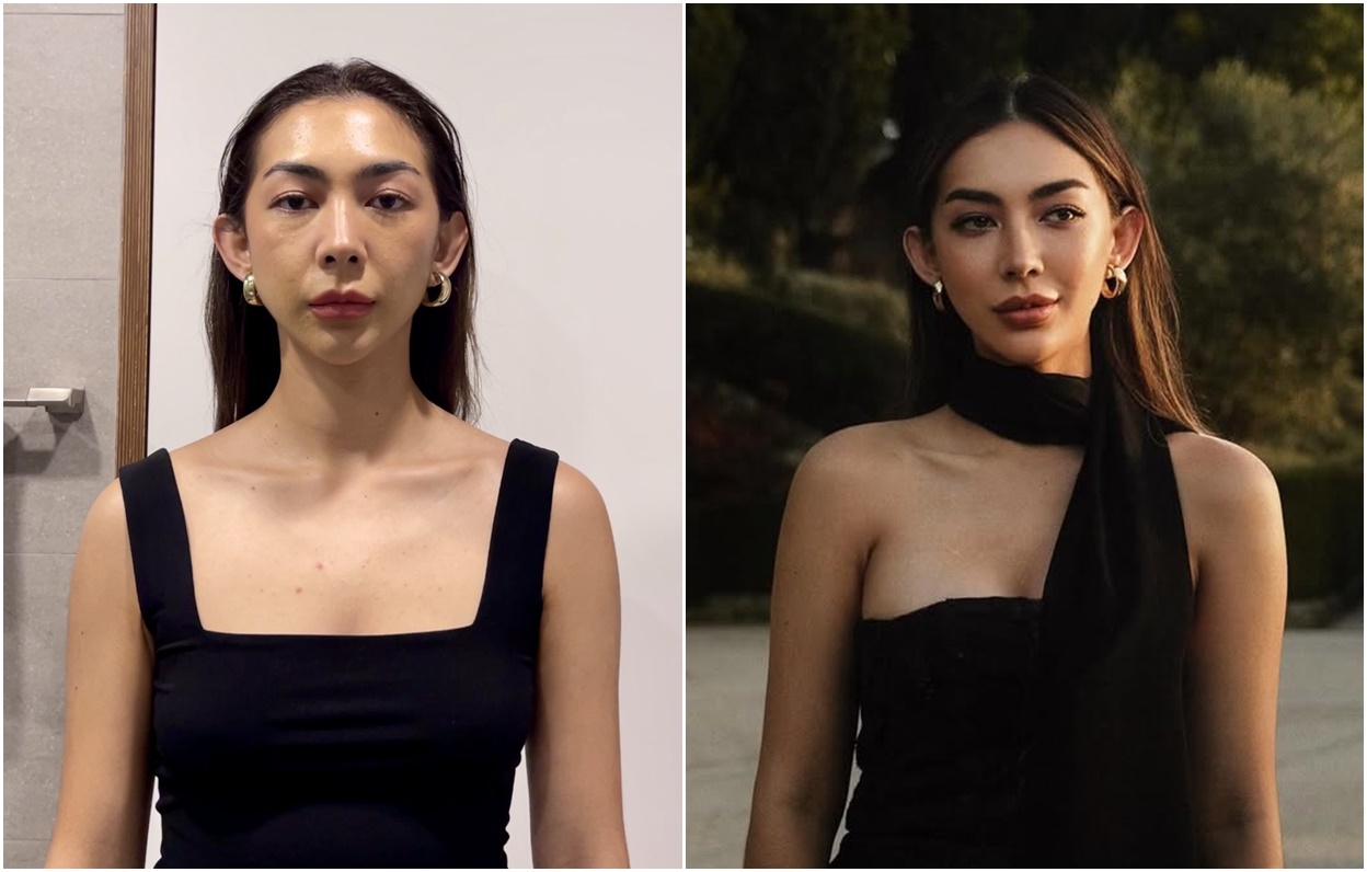 Payudara Bervolume dan Tampilan Lebih Muda Shania Salsabila