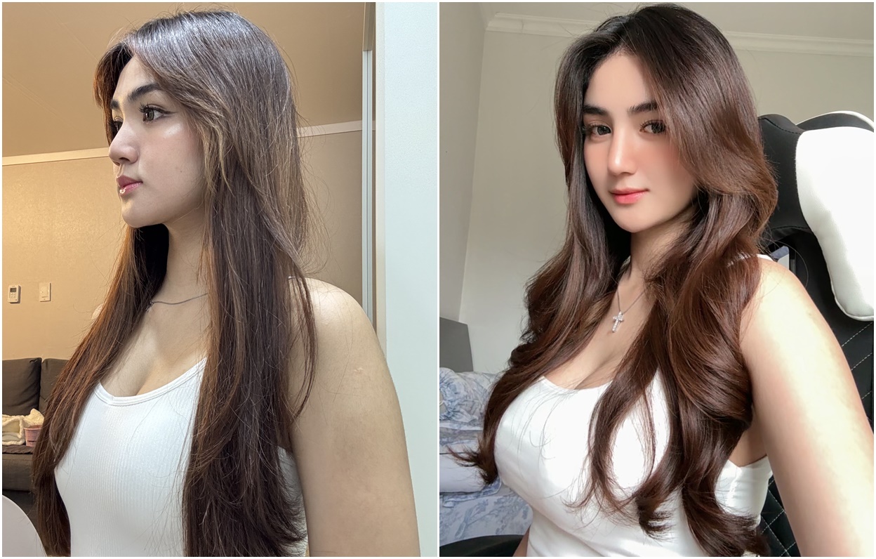 Pengalaman Operasi Plastik di Banobagi Korea, Real Story dari Awal sampai Setahun Setelahnya