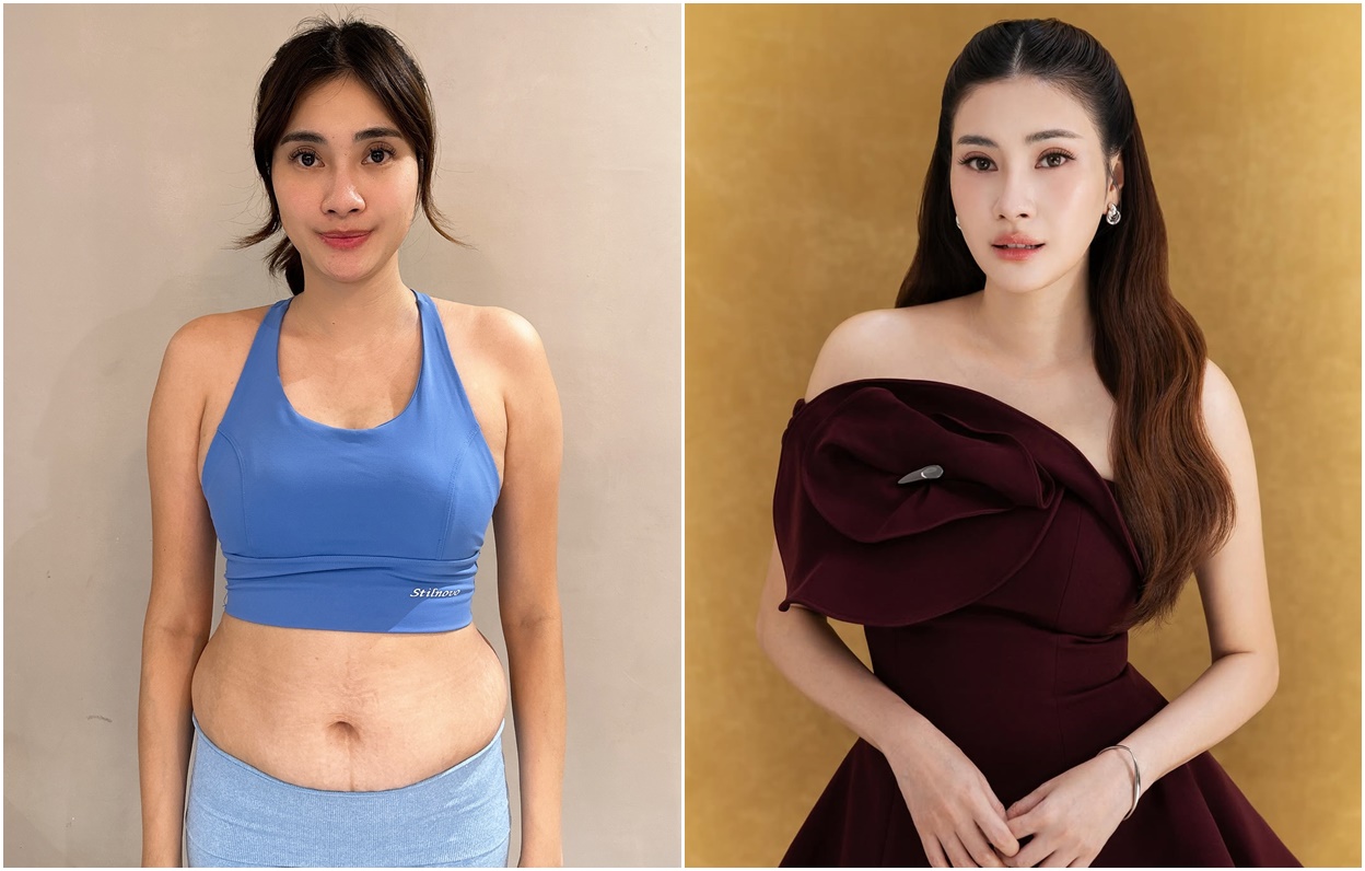 Transformasi Demmy Febriana: Dari 2 Minggu Hingga 10 Bulan, Ini Cerita di Baliknya