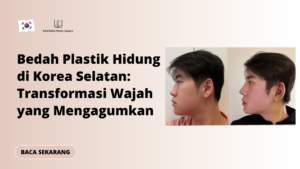 Bedah Plastik Hidung di Korea Selatan: Transformasi Wajah yang Mengagumkan