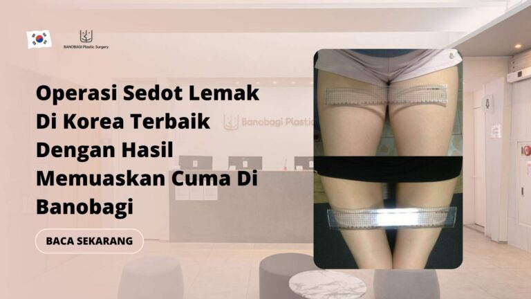 Operasi Sedot Lemak Di Korea Terbaik Dengan Hasil Memuaskan Cuma Di Banobagi