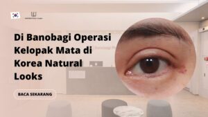 Di Banobagi Operasi Kelopak Mata di Korea Natural Looks
