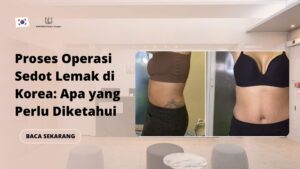 Proses Operasi Sedot Lemak di Korea: Apa yang Perlu Diketahui
