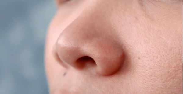 Prosedur pengecilan cuping hidung atau alaroplasty di Korea